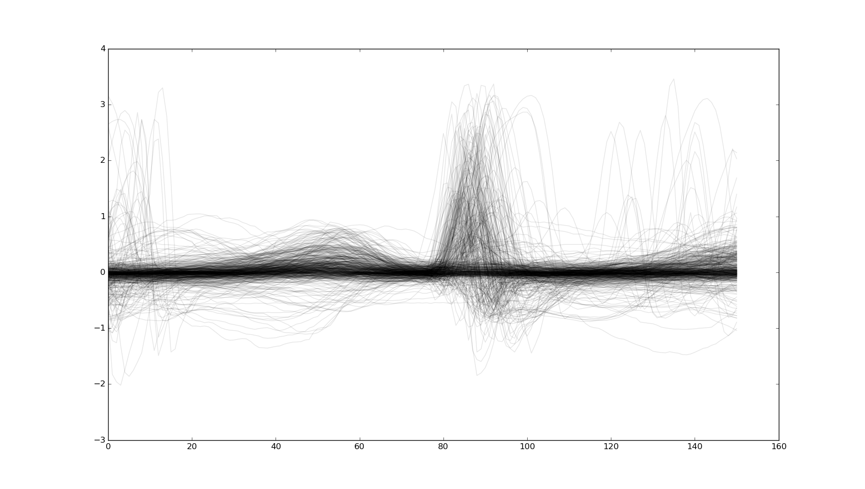 ECG-waves-varations